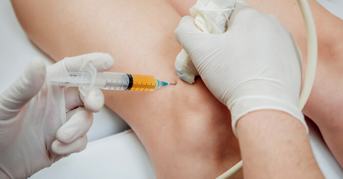 PRP Therapy (Platelet-Rich Plasma)